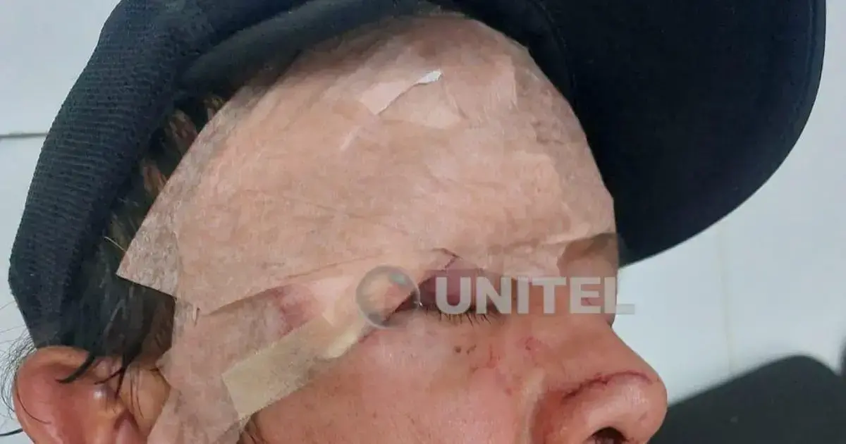 La víctima tuvo que ser atendida de emergencia