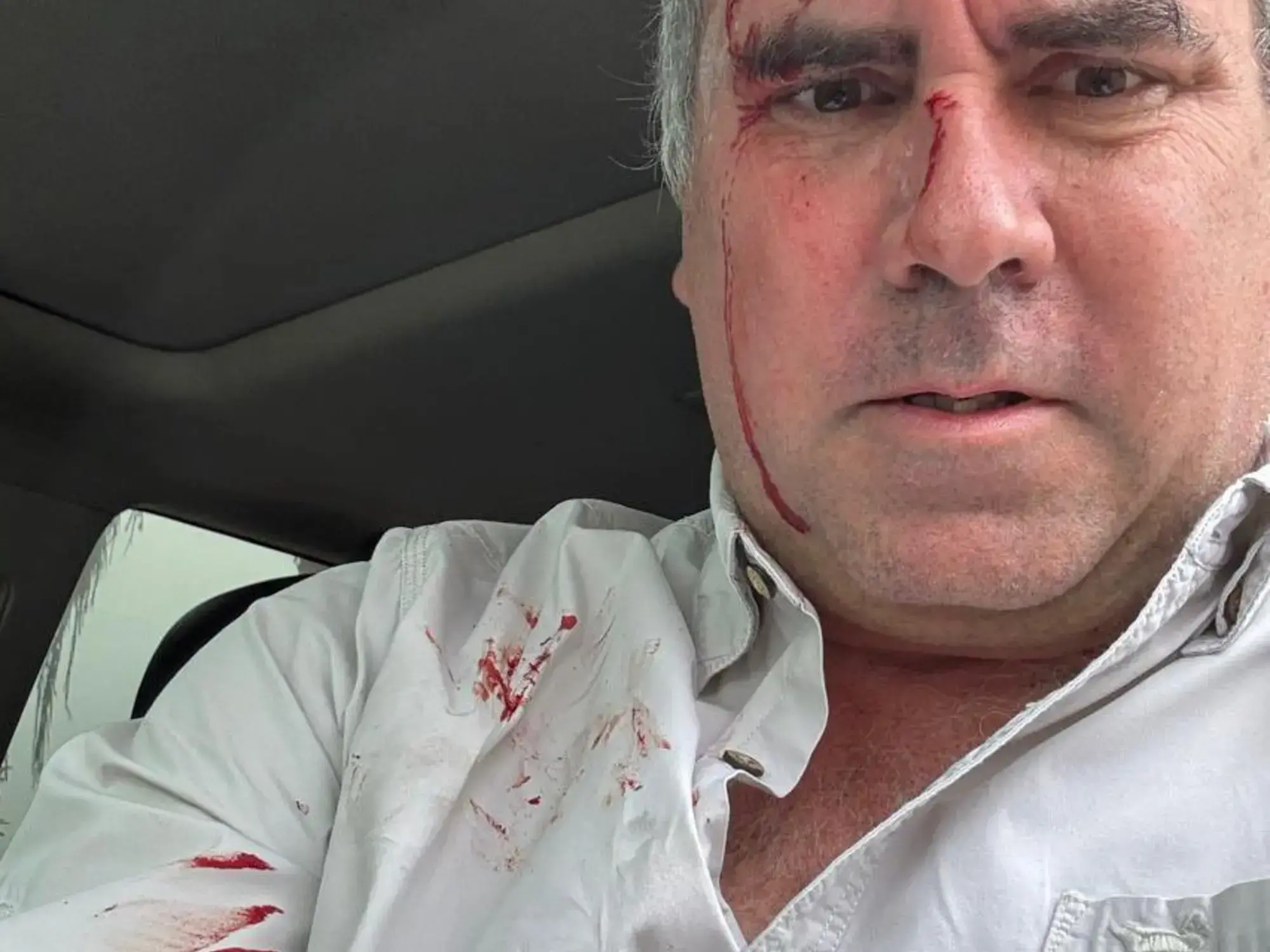 Rafael Belaúnde Llosa, herido después de sufrir un atentado en su contra.