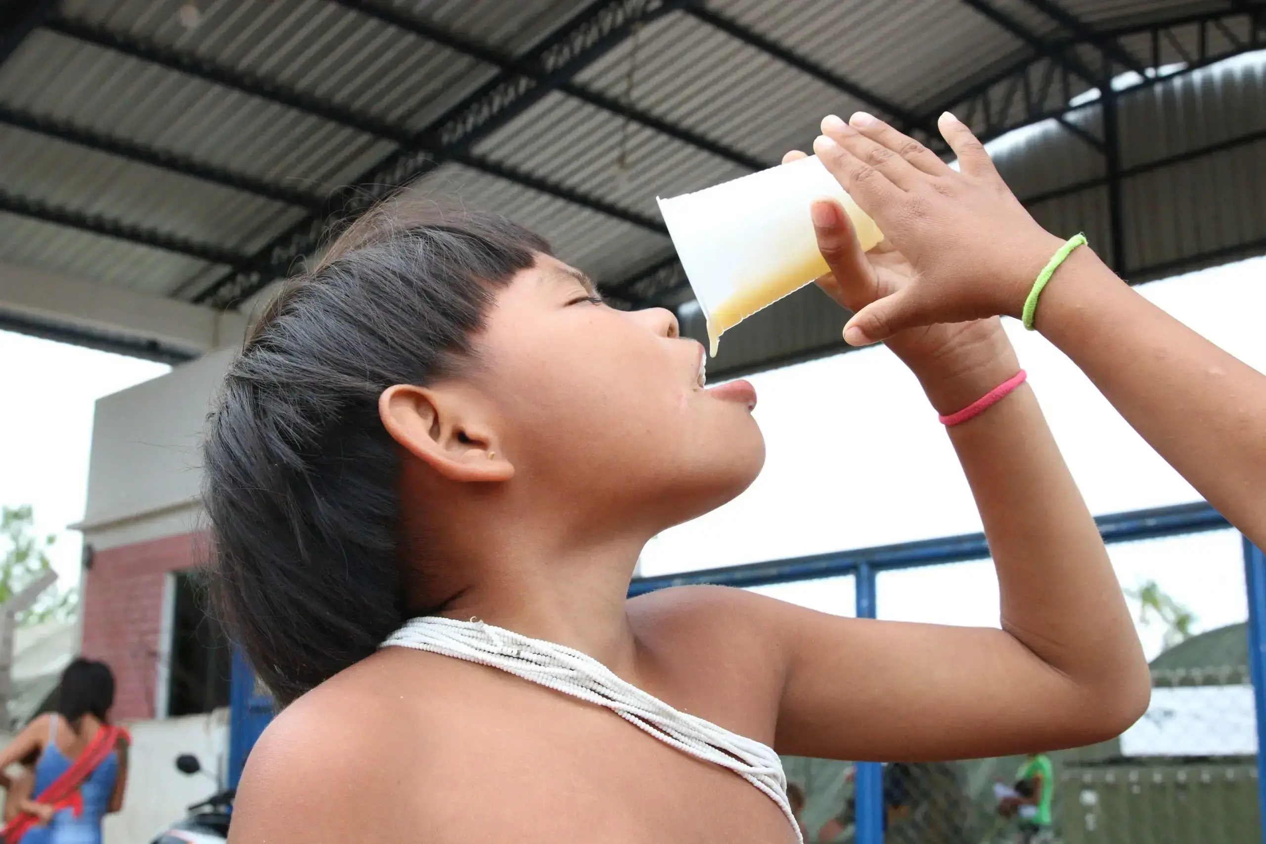Un niño Yanomami se alimenta en el hospital de emergencia establecido en Boa Vista en 2023.