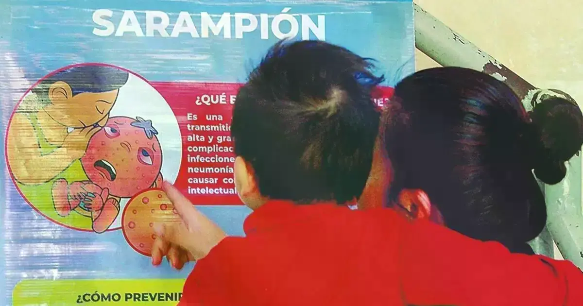 Campaña contra el sarampión