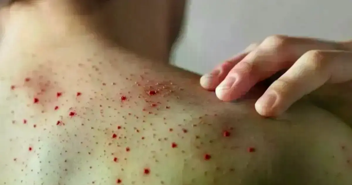 Imagen sin título