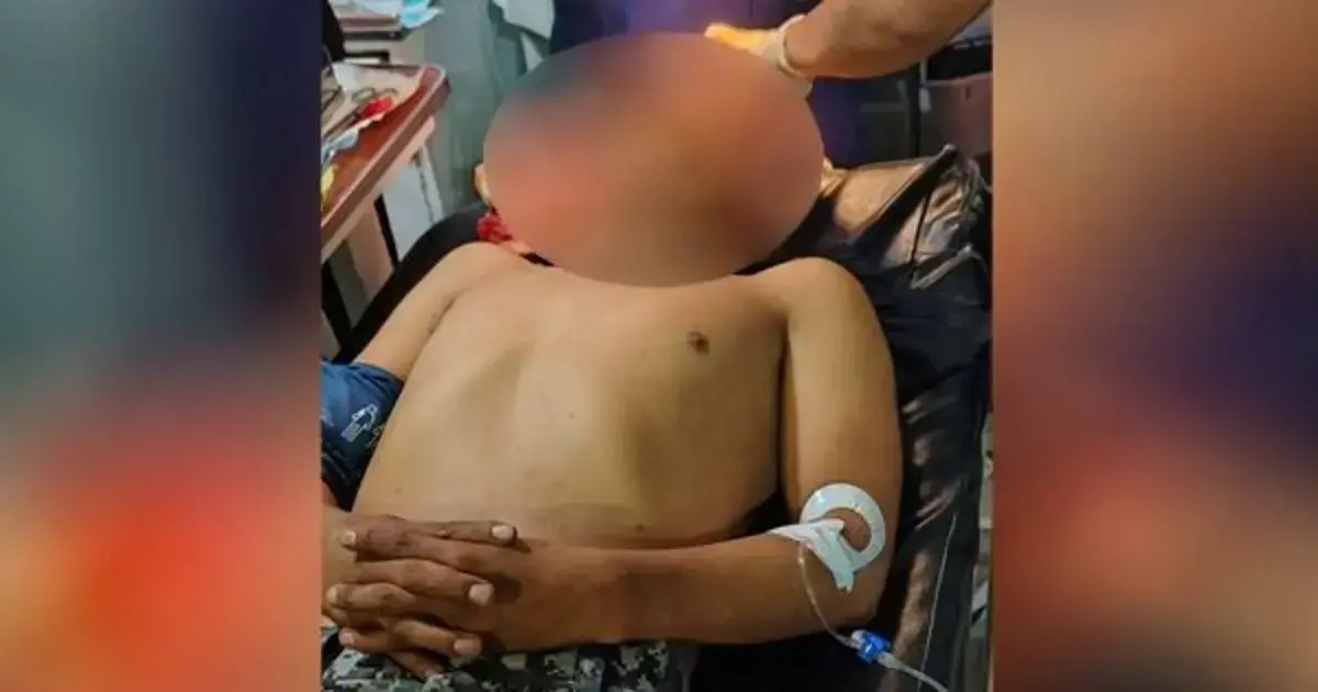 El casco que llevaba el policía herido tiene orificios de ingreso y de salida de la bala.