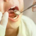 La niña murió tras una cirugía dental.