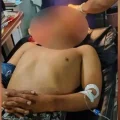El casco que llevaba el policía herido tiene orificios de ingreso y de salida de la bala.